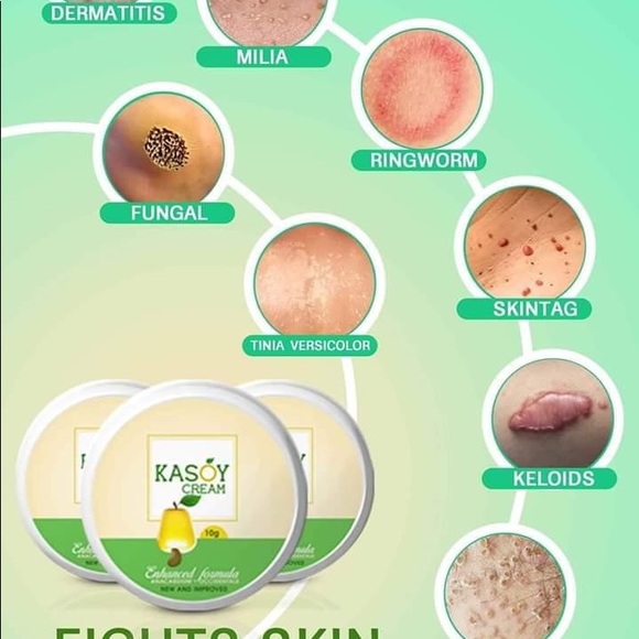 Kasoy Cream by Angel Touch skin tag keloid milia - Picture 7 of 9